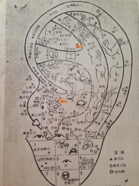 耳ツボ図 鍼灸aoi